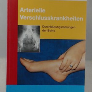 Arterielle Verschlusskrankheiten: Durchblutungsstörungen der Beine